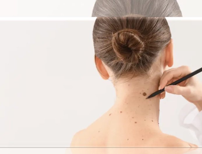 Confident models embrace authentic beauty by showcasing stretch marks in lingerie